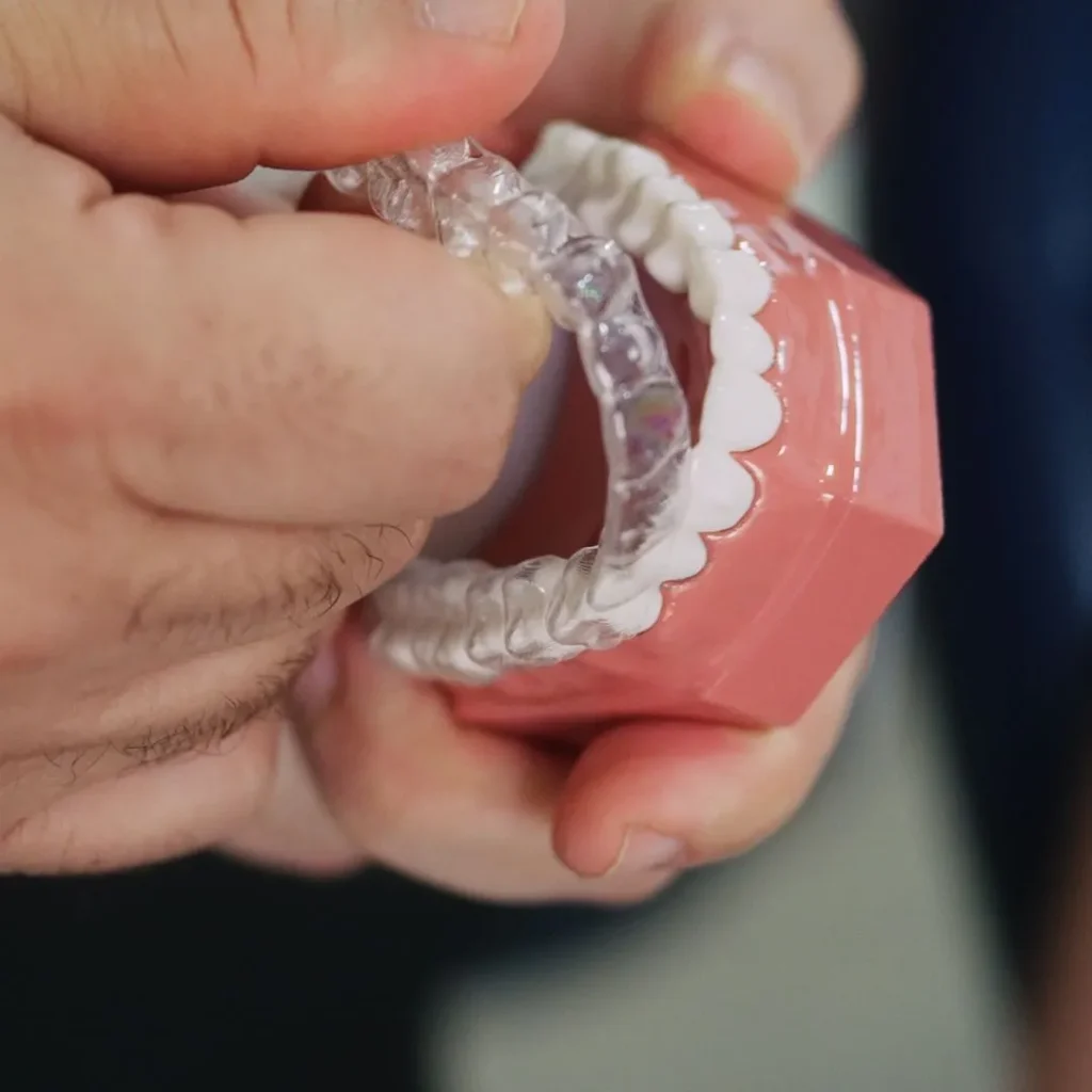 Transparent Orthodontics 1 clear aligners in dubai