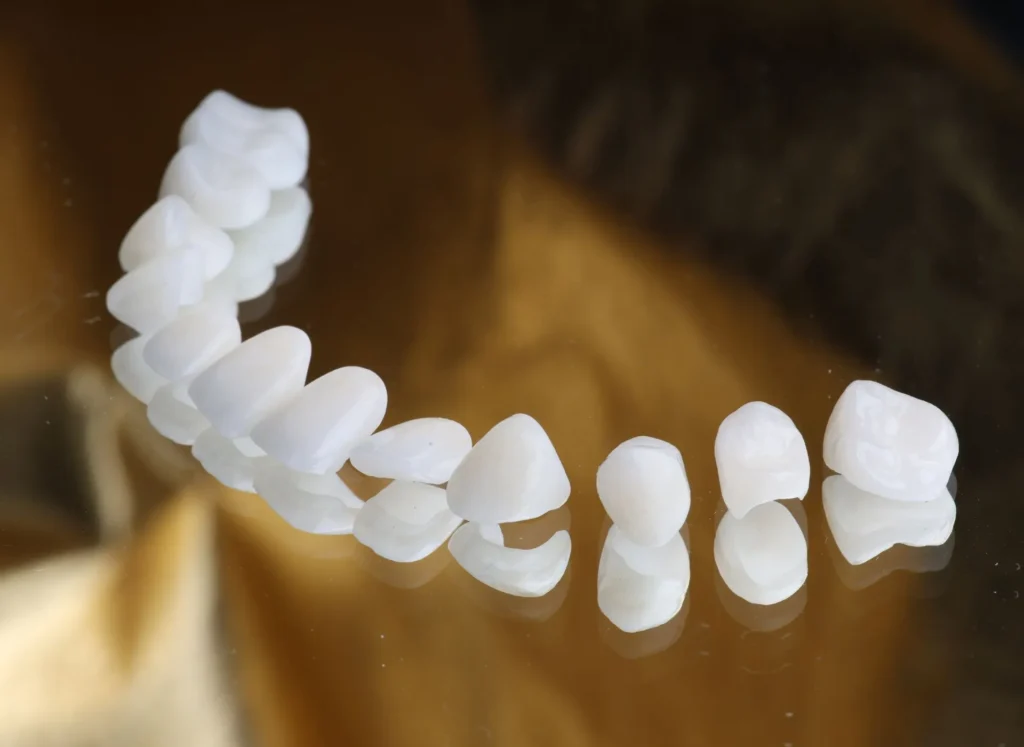 how to apply dental veneers